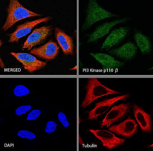 PI3 Kinase p110β Recombinant Rabbit mAb (S-1193-115)