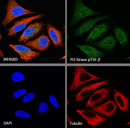 PI3 Kinase p110β Recombinant Rabbit mAb (S-1193-115)
