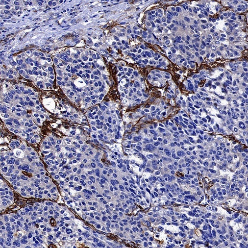 Phospho-Vimentin (Ser39) Rabbit Polyclonal Antibody