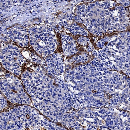 Phospho-Vimentin (Ser39) Rabbit Polyclonal Antibody