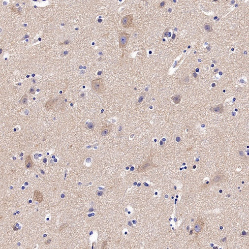 VPS35 Recombinant Rabbit mAb (S-997-2)