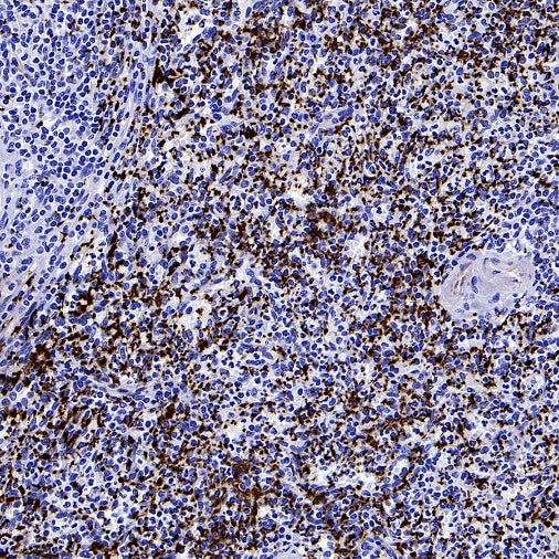 CD61 Recombinant Rabbit mAb (S-2515-6)