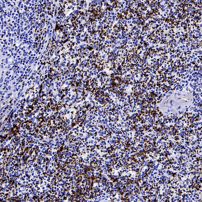 CD61 Recombinant Rabbit mAb (S-2515-6)