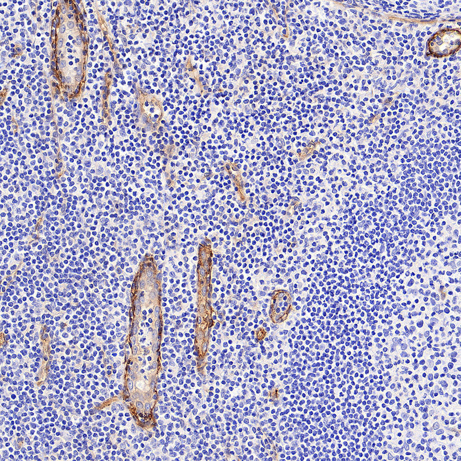EPCR/PROCR (CD201) Rabbit Polyclonal Antibody
