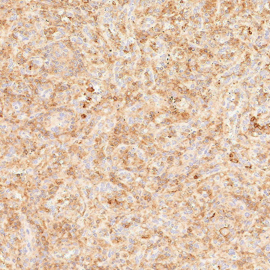 CDC42 Recombinant Rabbit mAb (S-6126)