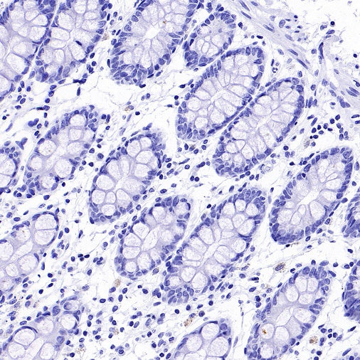 TMEM16A Recombinant Rabbit mAb (SDT-2179-68)