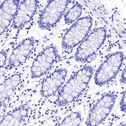 TMEM16A Recombinant Rabbit mAb (SDT-2179-68)