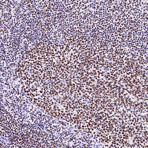 IKAROS Recombinant Rabbit mAb (S-R264)