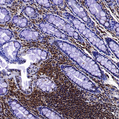 mTOR Recombinant Rabbit mAb (S-698-228)