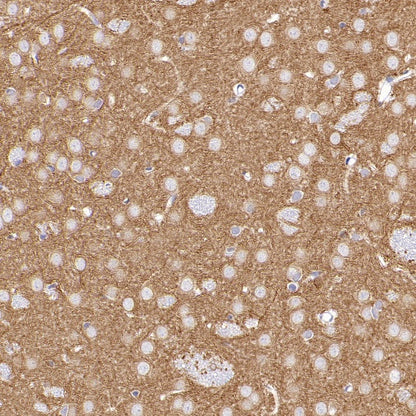 MAP2 Recombinant Rabbit mAb, PBS Only (SDT-2060-28)