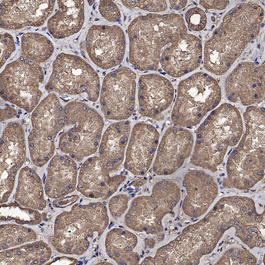 SREBF1 Mouse mAb
