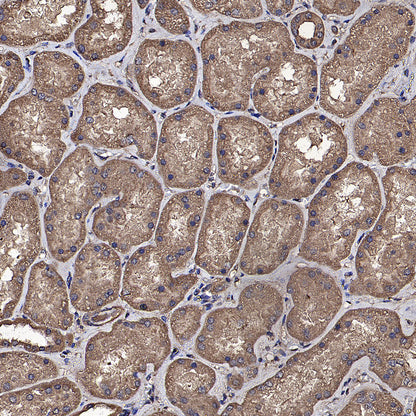 SREBF1 Mouse mAb