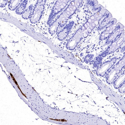 Calretinin Recombinant Rabbit mAb (SDT-2773-21)