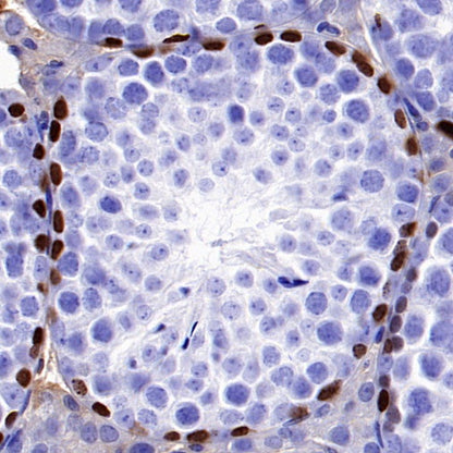 SALL4 Recombinant Rabbit mAb (SDT-1484-1)