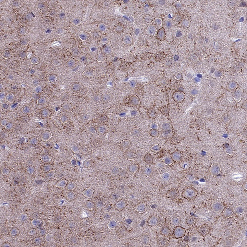 KCNB1 Recombinant Rabbit mAb (S-2527-21)
