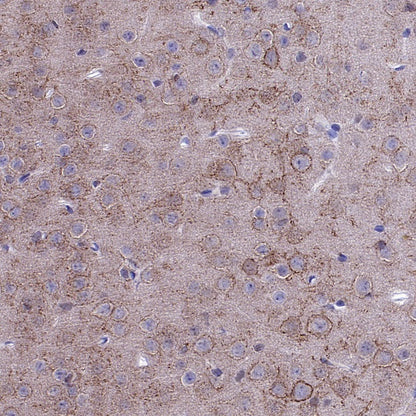 KCNB1 Recombinant Rabbit mAb (S-2527-21)