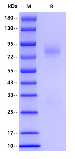 Tau-441/2N4R His Tag Protein, Human