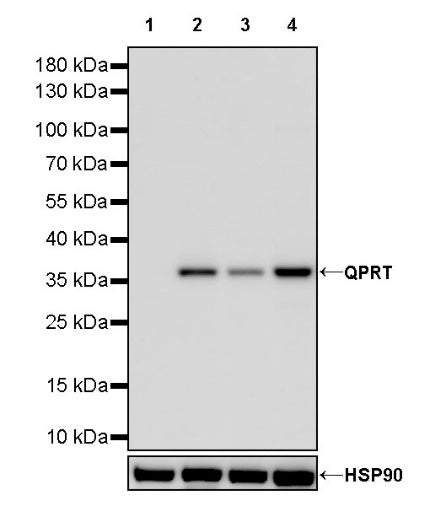 QPRT Recombinant Rabbit mAb (S-1228-31)