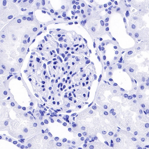 Arginase-1 Recombinant Rabbit mAb (SDT-369-33)