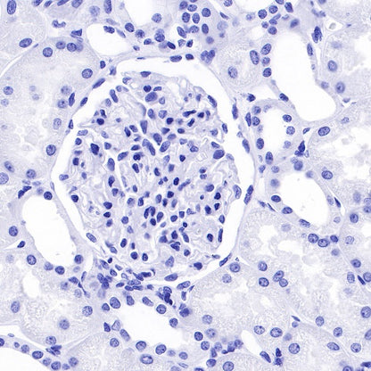 Arginase-1 Recombinant Rabbit mAb (SDT-369-33)