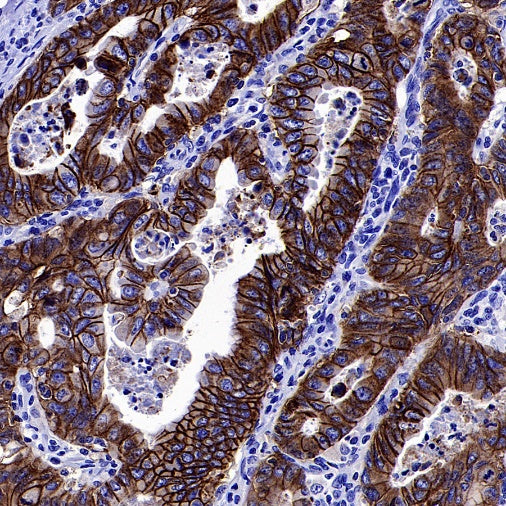 S-RMab® EpCAM Recombinant Rabbit mAb (SDT-078-128)