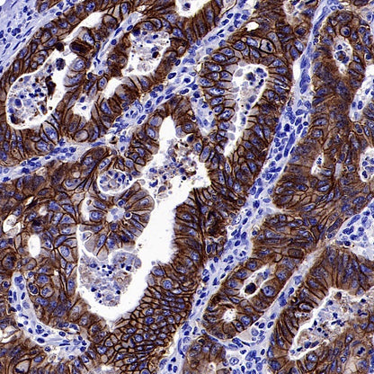 S-RMab® EpCAM Recombinant Rabbit mAb (SDT-078-128)