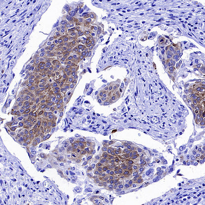Cytokeratin 1 Recombinant Rabbit mAb (SDT-3225-22)