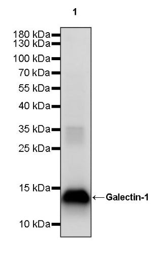Galectin-1/LGALS1 Rabbit Polyclonal Antibody