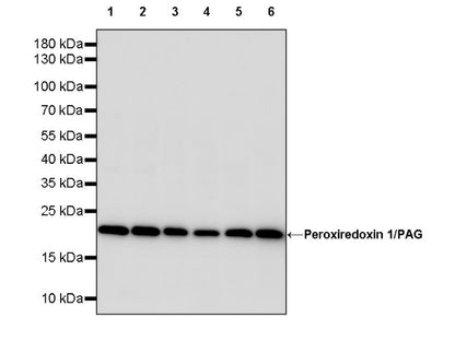 Peroxiredoxin 1/PAG Recombinant Rabbit mAb (S-1673-22)