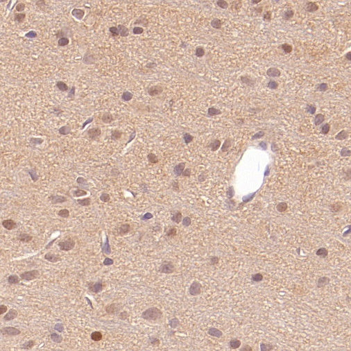 UBE2F Recombinant Rabbit mAb (S-2672-26)