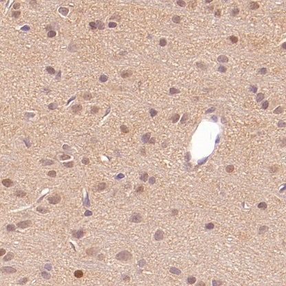 UBE2F Recombinant Rabbit mAb (S-2672-26)