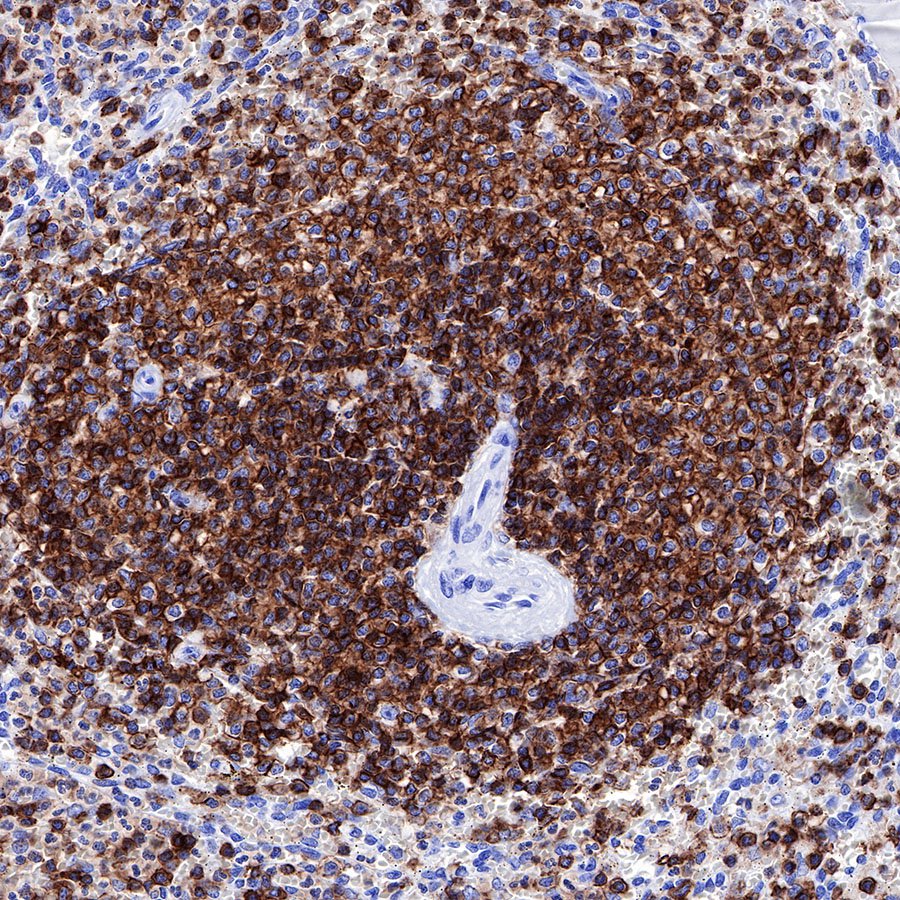 S-RMab® CD45 Recombinant Rabbit mAb,PBS Only (SDT-R035)