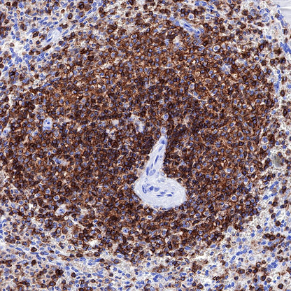 S-RMab® CD45 Recombinant Rabbit mAb,PBS Only (SDT-R035)