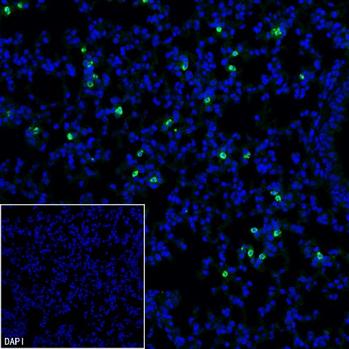 Lipocalin-2/NGAL Recombinant Rabbit mAb (S-2280-129)