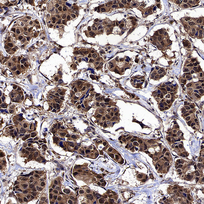 CNBP Recombinant Rabbit mAb (S-4288-3)