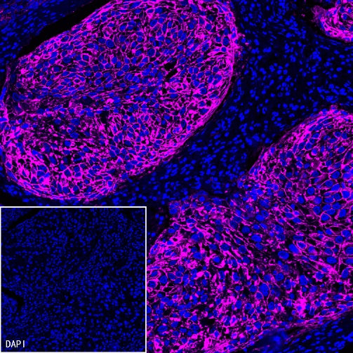 Claudin 1 Recombinant Rabbit mAb (SDT-1289-55)