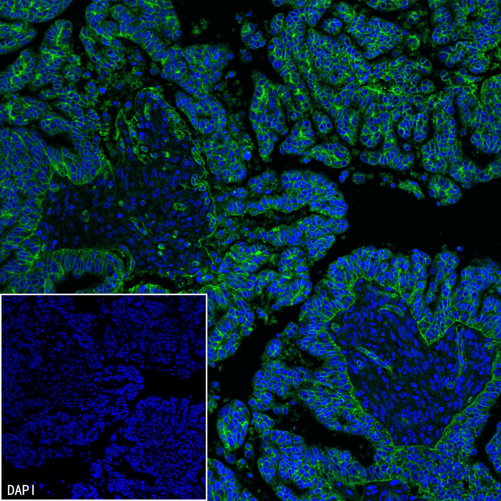 CD151 Recombinant Rabbit mAb (S-3235-104)