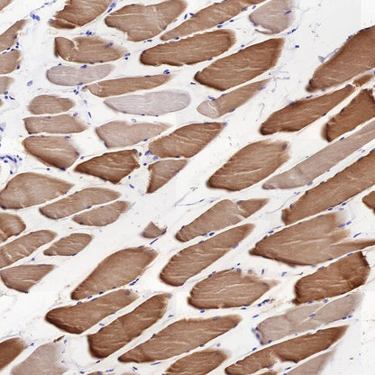 Alpha B Crystallin Recombinant Rabbit mAb (S-R216)