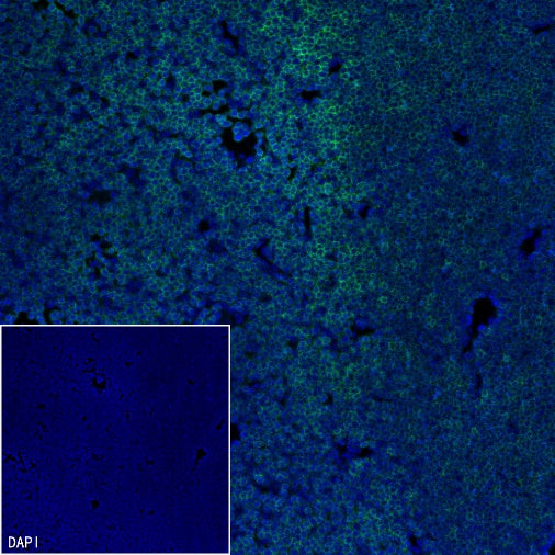 CD45 Recombinant Rabbit mAb (S-3361)