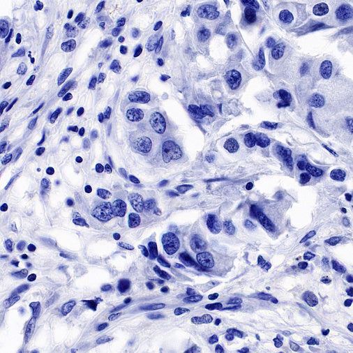 DDX4 Recombinant Rabbit mAb (S-1570-48)