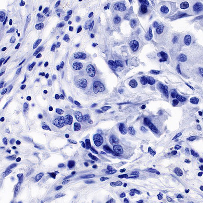 DDX4 Recombinant Rabbit mAb (S-1570-48)