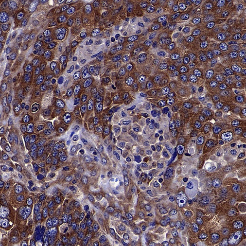 TRIM25 Recombinant Rabbit mAb (S-4069-59)