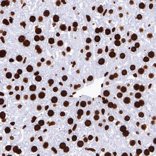Histone H3 (mono methyl K36) Recombinant Rabbit mAb (S-R211)