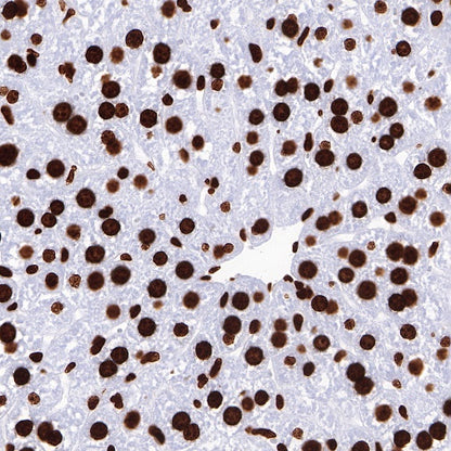 Histone H3 (mono methyl K36) Recombinant Rabbit mAb (S-R211)