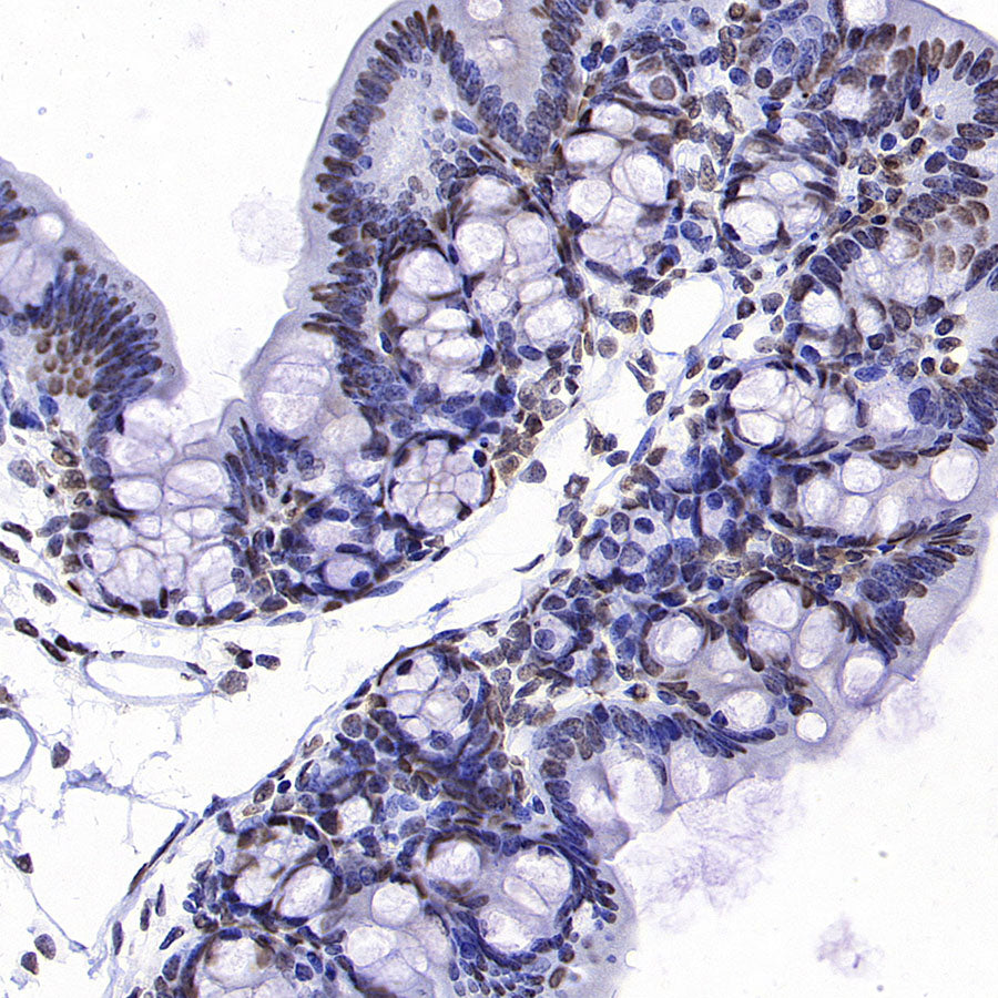 HNRNPA2B1 Mouse mAb