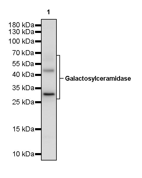 Galactosylceramidase Recombinant Rabbit mAb (S-3402-17)