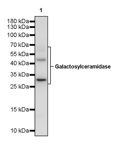 Galactosylceramidase Recombinant Rabbit mAb (S-3402-17)