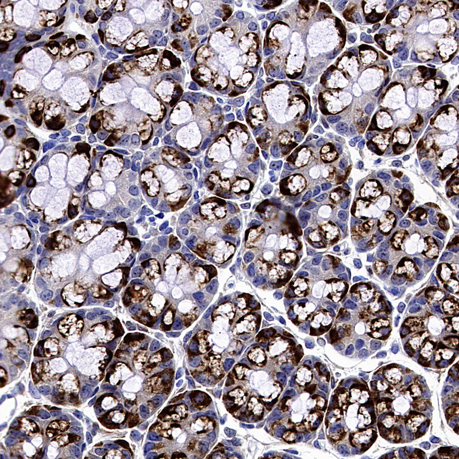 SCTR Recombinant Rabbit mAb (S-3949-52)