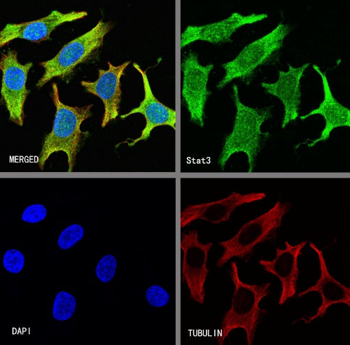 Stat3 Recombinant Rabbit mAb (S-1393-64)