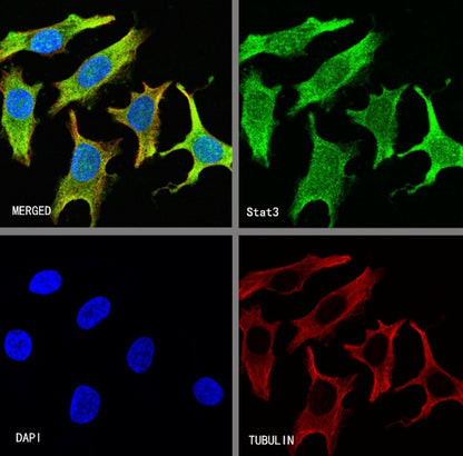 Stat3 Recombinant Rabbit mAb (S-1393-64)